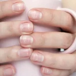 Nail Health | सावधान! नखांवरील ‘हे’ ५ बदल म्हणजे गंभीर आजाराची लक्षणे; चुकूनही करू नका दुर्लक्ष
