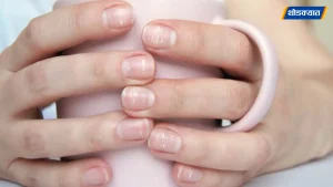 White-Spots-On-Nails.webp.webp