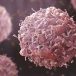 साध्या थकव्याचे रूपांतर दुर्मिळ कॅन्सरमध्ये:नाशिकच्या 55 वर्षीय शेतकऱ्याची मृत्यूशी झुंज यशस्वी; 14 सेंमी आकाराचा आढळून आला ट्यूमर