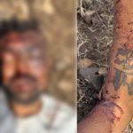 उमरदरी शिवारात तरुणाचा मृतदेह आढळला:अंगावरील जखमांमुळे खून झाल्याचे स्पष्ट, ओळख पटविण्याचे काम सुरू